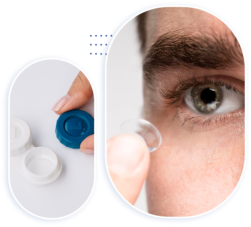 Contact Lenses Consultation image