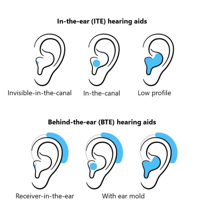 Hearing Aids 101 image